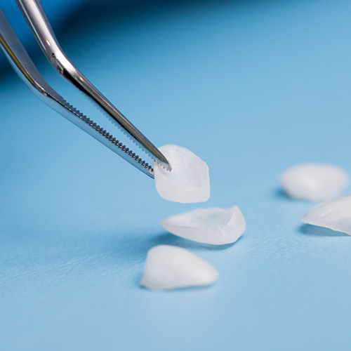 Close up of veneers being picked up by metal instrument