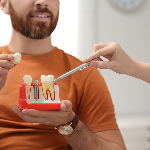 Dental patient holding model of dental implant